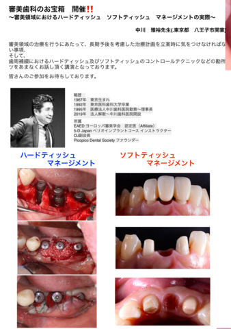 11月3日（月祝）「審美歯科のお宝箱」開催‼ | GDS:歯科医をサポート